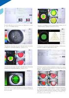Топограф роговицы CT-800
